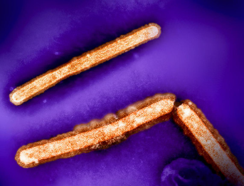 H5N1 avian influenza particles